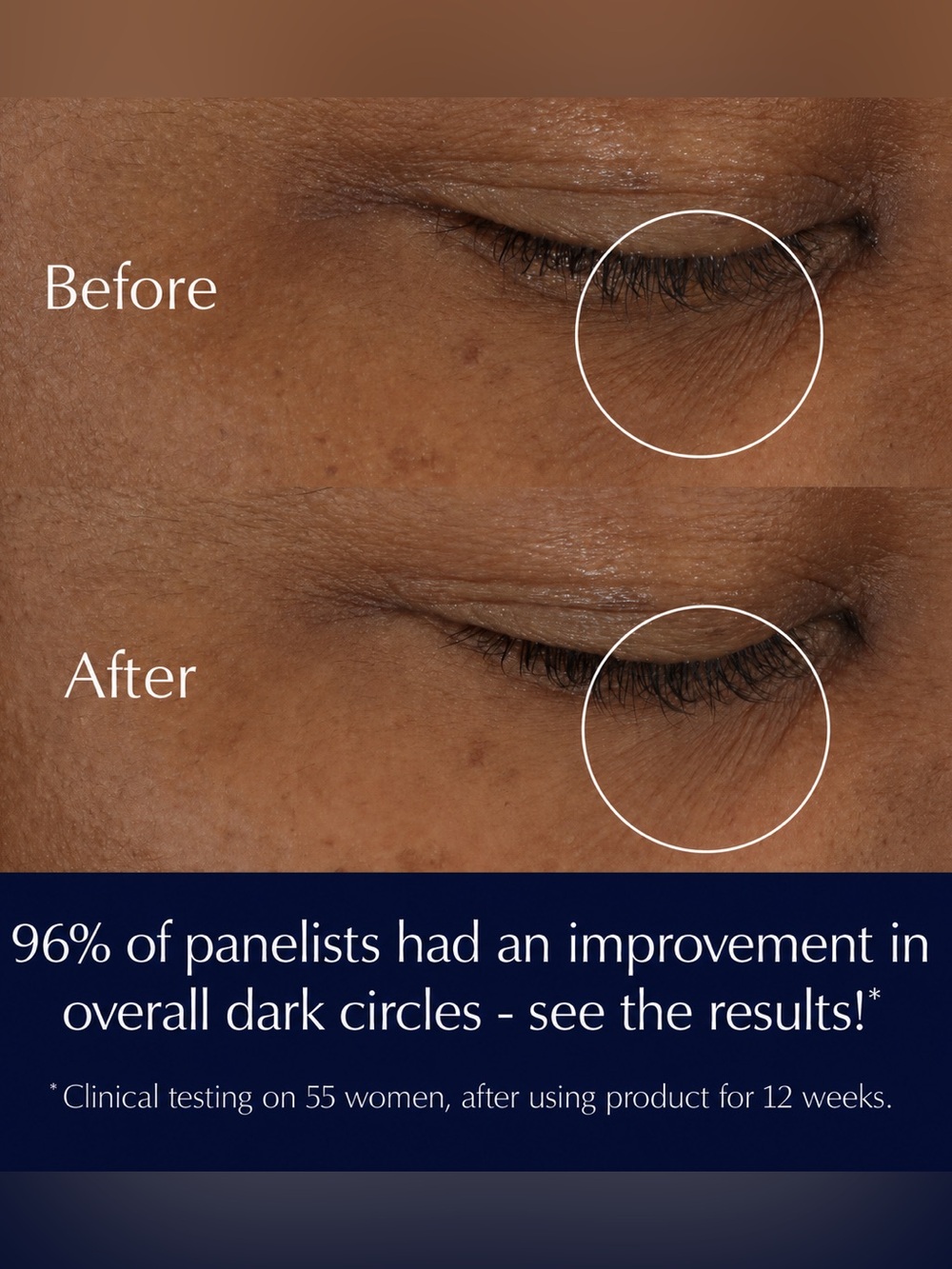 Advanced Night Repair Eye Supercharged Gel-Creme (full size) - Picture 5 of 5